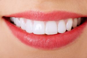 misconceptions about cosmetic dentistry